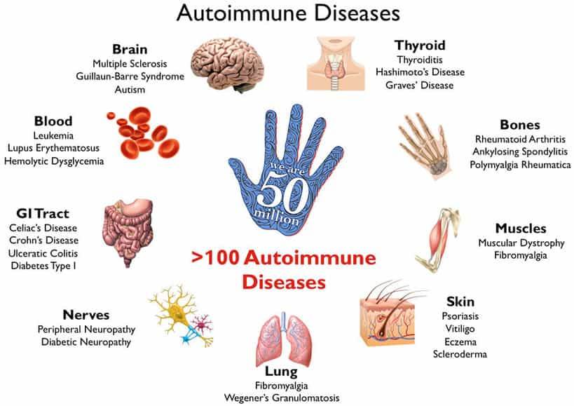 Common Food Sensitivities, autoimmune disease, types of autoimmune diseases, what is autoimmune disease