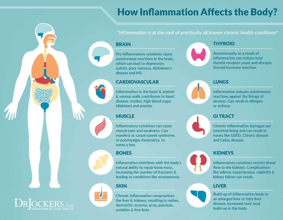 Chronic Inflammation, what is chronic inflammation, how does inflammation affect the body, inflammation in the body, foods that cause inflammation
